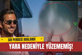 Halit Yukay Karnındaki Yar Nedeniyle Yüzememiş