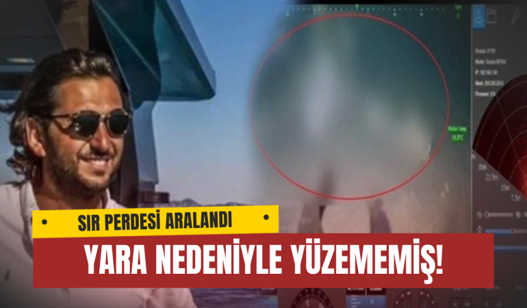 Halit Yukay Karnındaki Yar Nedeniyle Yüzememiş