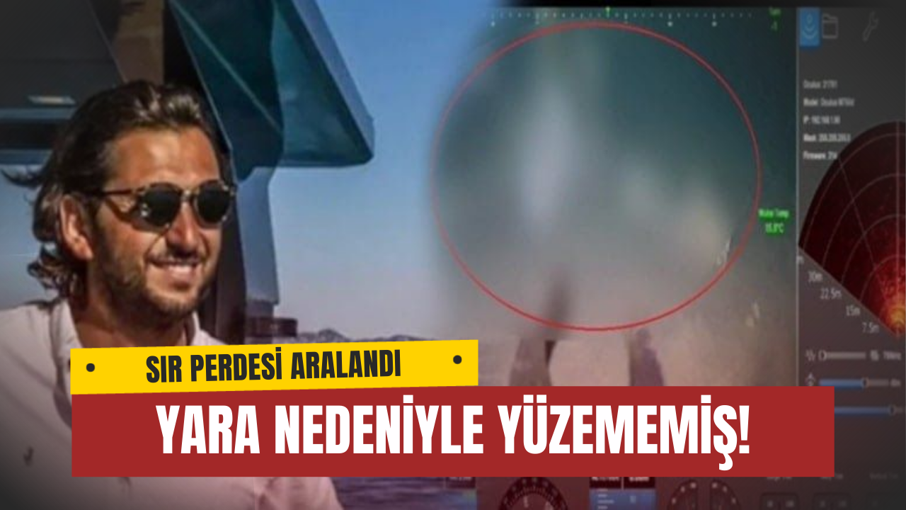 Halit Yukay Karnındaki Yar Nedeniyle Yüzememiş
