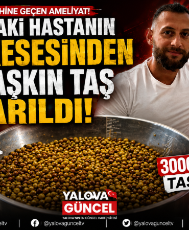 Yalova’da 76 Yaşındaki Hastanın Vücudundan 3 Bini Aşkın Taş Çıkarıldı